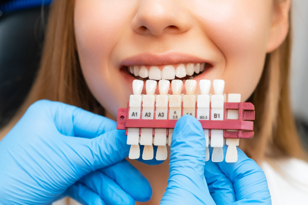 What To Do If Dental Veneers Come Off