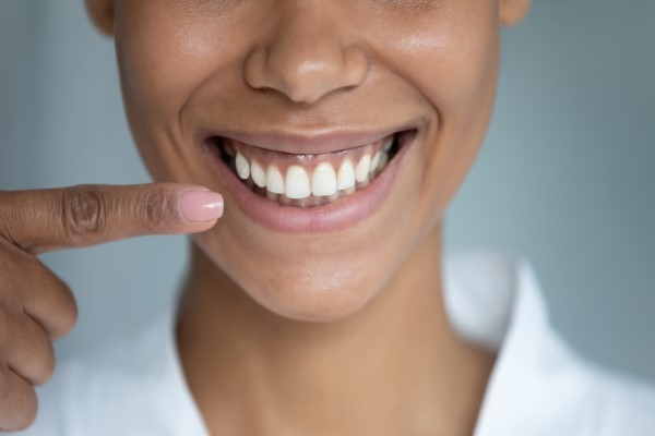 Who Is A Good Candidate For Veneers?