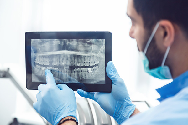 General Dentistry: Are Dental X Rays Recommended?
