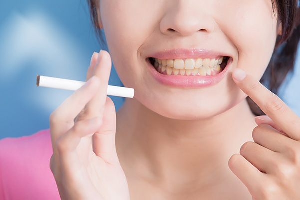General Dentistry: How Smoking Can Harm Your Teeth from South Florida Dentistry in Miami, FL