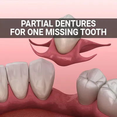 Visit our Partial Denture for One Missing Tooth page