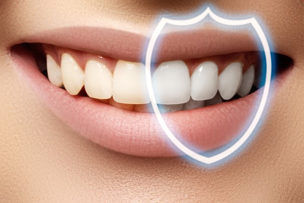 Is Professional Teeth Whitening Right For You?